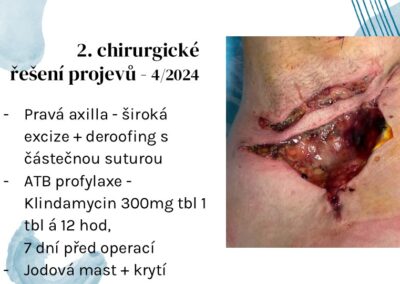 Snímek13