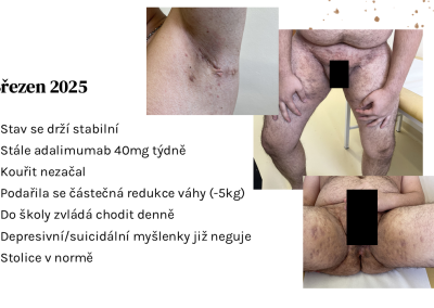 Snímek13